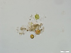 微生物2(x40)