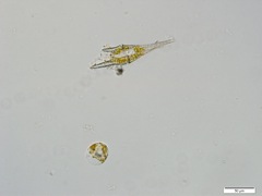 微生物3(x40)上Ceratium　furca