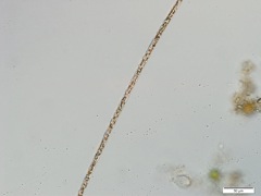 微生物4(x40)