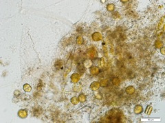 微生物5(x40)